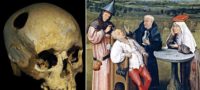 Picture 13 Bizarre Historical Medical Treatments