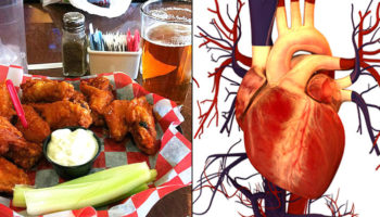 Picture The Mystery of Transplant Patients Craving Things the Donors Preferred