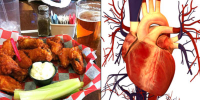 Picture The Mystery of Transplant Patients Craving Things the Donors Preferred