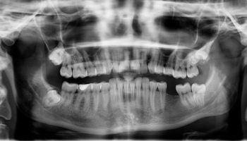 Picture 10 Facts that Sound Fake But are 100% True