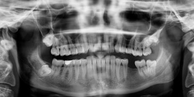 Picture 10 Facts that Sound Fake But are 100% True