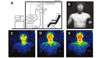 Picture 10 Fascinating Phenomena in the Human Body