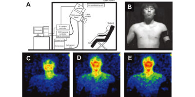 Picture 10 Fascinating Phenomena in the Human Body