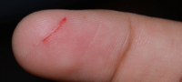Picture Why Does a Paper Cut Hurt so Much?