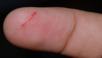 Picture Why Does a Paper Cut Hurt so Much?