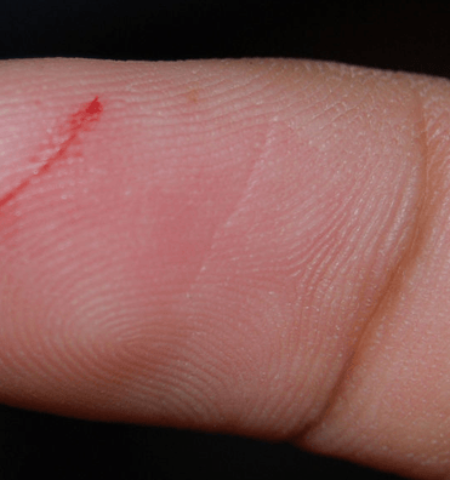 Picture Why Does a Paper Cut Hurt so Much?