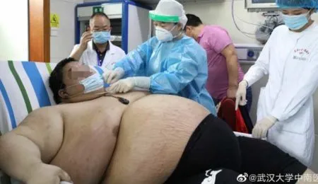 Picture A Chinese Man Gains 100 Kilograms During a Five-Month Lockdown Making Him the Fattest Person in Wuhan, China