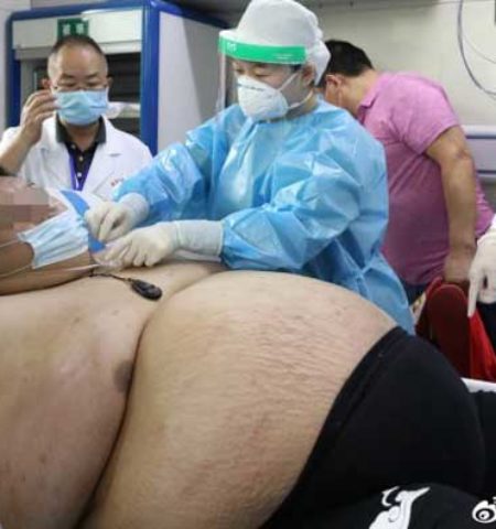 Picture A Chinese Man Gains 100 Kilograms During a Five-Month Lockdown Making Him the Fattest Person in Wuhan, China