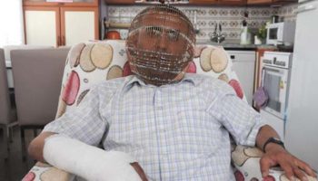 Picture A Turkish Man, Ibrahim Yucel, Locks Himself in a Copper Helmet to Quit Smoking Cigarettes
