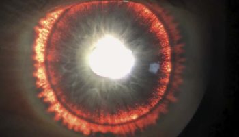 Picture 10 Extraordinary Medical Cases that Surprised Even the Doctors