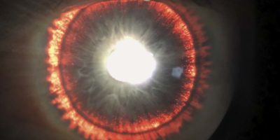 Picture 10 Extraordinary Medical Cases that Surprised Even the Doctors