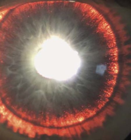 Picture 10 Extraordinary Medical Cases that Surprised Even the Doctors