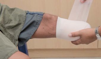 Picture 10 of the Most Horrifying Medical Blunders of All Time