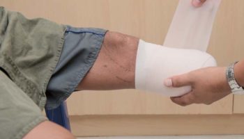 Picture 10 of the Most Horrifying Medical Blunders of All Time