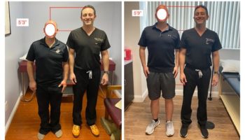 Picture Leg-lengthening Surgery Is A Complex Procedure That Some People Undergo To Increase Their Heights