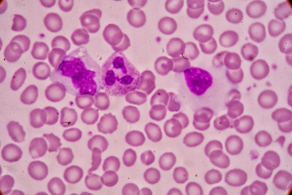 John Moore Was Treated By a Cancer Researcher, Who Developed And ...