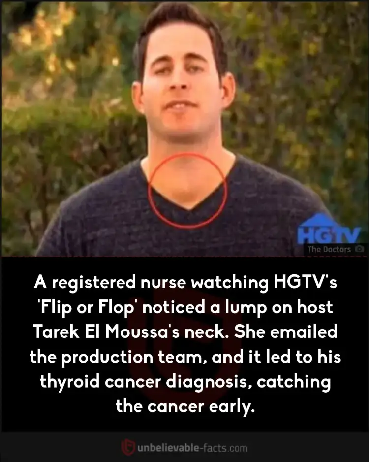 host Tarek El Moussa's neck