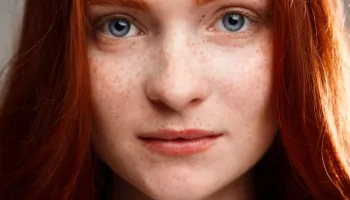 Picture Redheads efficiently produce vitamin D in low-light conditions
