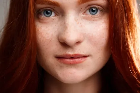 Picture Redheads efficiently produce vitamin D in low-light conditions