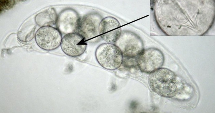A tardigrade cuticle full of eggs
