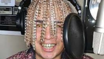 Picture Dan Sur Gets Gold Chain Implants as Hair