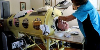 Picture The Story of the Man Living Inside an Iron Lung for the Last 70 Years