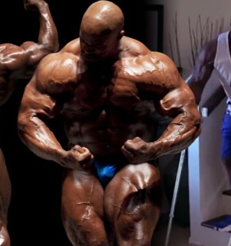 Picture From Absolute Muscle Unit to Walking on Crutches — What Went Wrong with Ronnie Coleman?