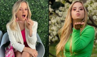 Picture Victoria’s Secret Unveils the First Model with Down Syndrome