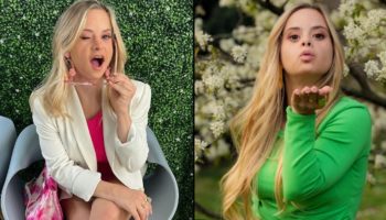 Picture Victoria’s Secret Unveils the First Model with Down Syndrome