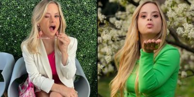 Picture Victoria’s Secret Unveils the First Model with Down Syndrome