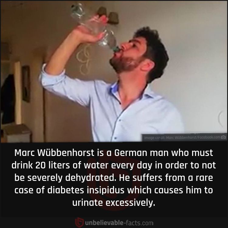 A Man Who Must Drink 20 Liters of Water a Day