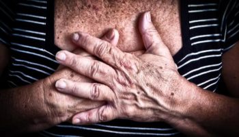 Picture Doctors on Plane Saved Woman Having a Heart Attack During Flight