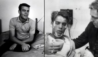 Picture Man Who Didn’t Sleep for a Record 264 Hours Suffered From Crippling Effects for Years After