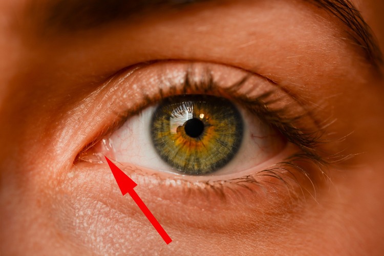 residual nictitating membrane in human eye