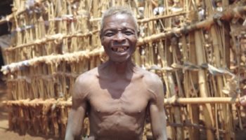 Picture An African Man Has Been Living in Isolation for 55 Years Due to His Fear of Women