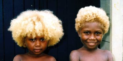 Picture The Blond Hair of Dark-skinned Melanesians Have No European Origins