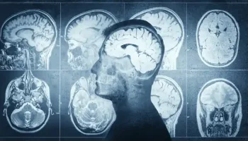 Picture Chris Sands’ hiccups revealed a tumor; removal saved his life