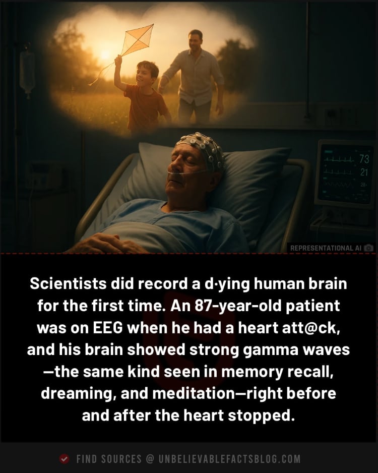First-ever dying-brain recording showed memory-like gamma waves.