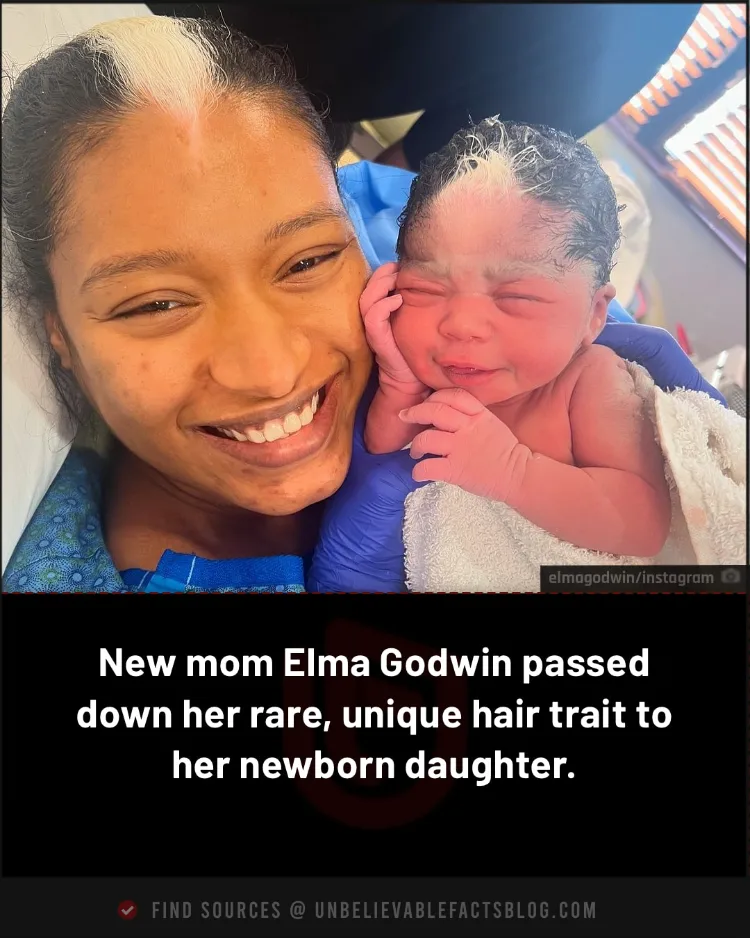 New mum Elma Godwin passed down her rare, unique hair trait