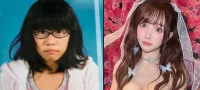 Picture Japanese Influencer Unrecognizable After 8 Years of Plastic Surgery Transformations