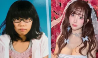 Picture Japanese Influencer Unrecognizable After 8 Years of Plastic Surgery Transformations