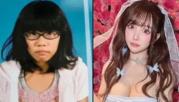 Picture Japanese Influencer Unrecognizable After 8 Years of Plastic Surgery Transformations
