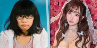 Picture Japanese Influencer Unrecognizable After 8 Years of Plastic Surgery Transformations