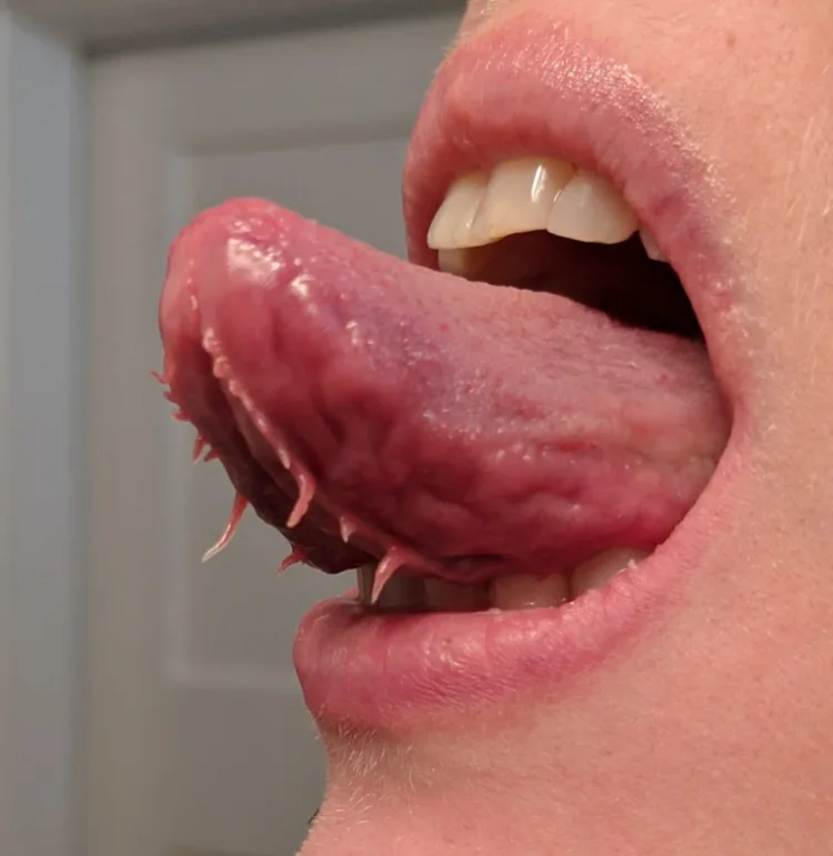 tongue tentacles