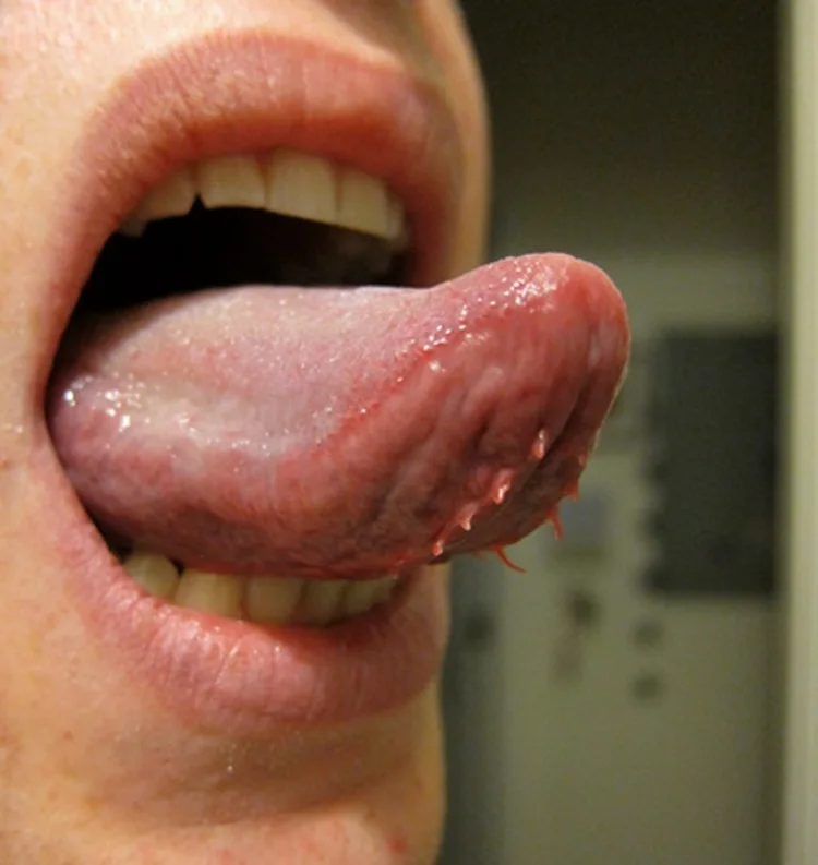 Tongue tentacles