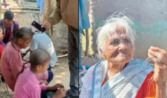 Picture A Mysterious Outbreak is Making People Bald in Just Three Days