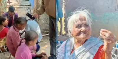 Picture A Mysterious Outbreak is Making People Bald in Just Three Days