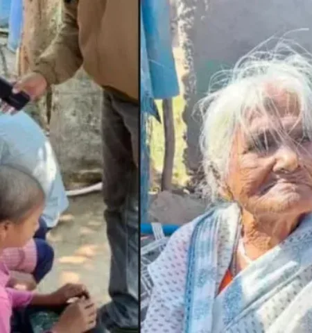 Picture A Mysterious Outbreak is Making People Bald in Just Three Days