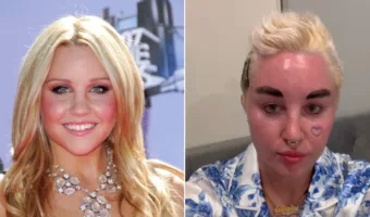 Picture 10 Celebrities Who Have Transformed Dramatically Over the Years