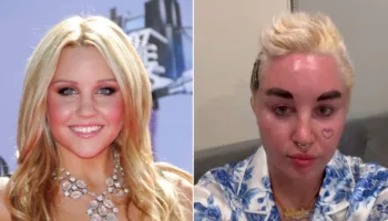 Picture 10 Celebrities Who Have Transformed Dramatically Over the Years